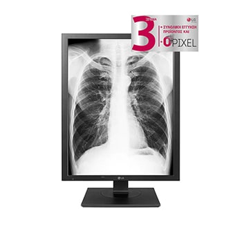 Front view with infill image1