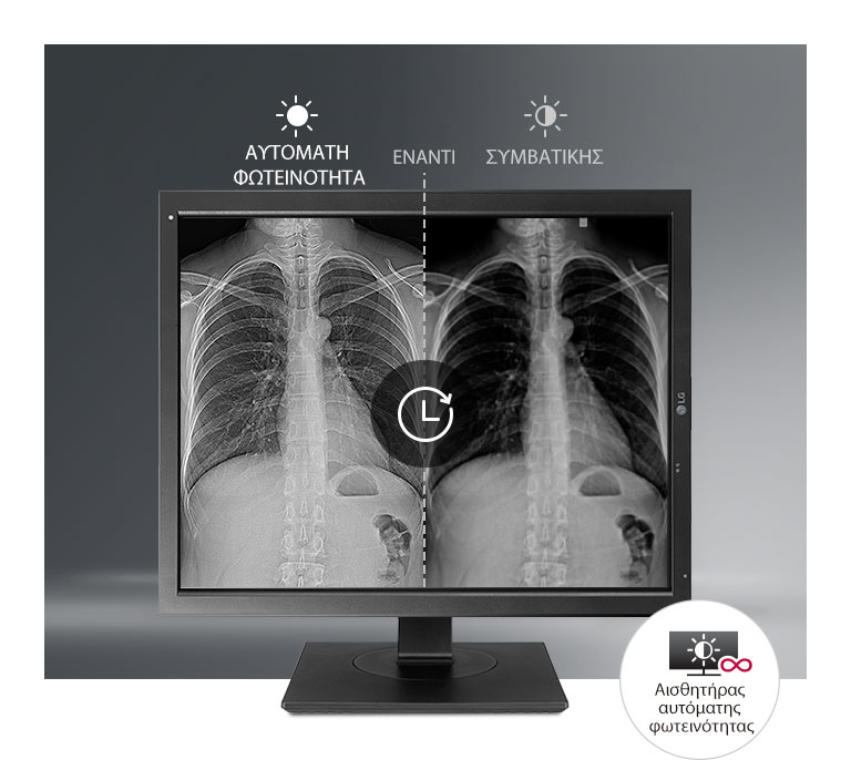 Αυτόματη σταθεροποίηση φωτεινότητας