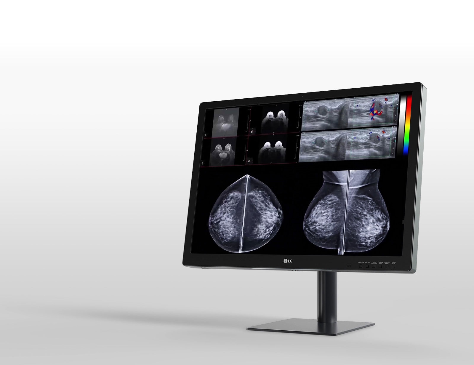 οθόνη lg ips 12mp 31 ιντσών, σχεδιασμένη για μαστογραφίες, παρέχοντας απρόσκοπτη ροή εργασιών και βελτιωμένη άνεση