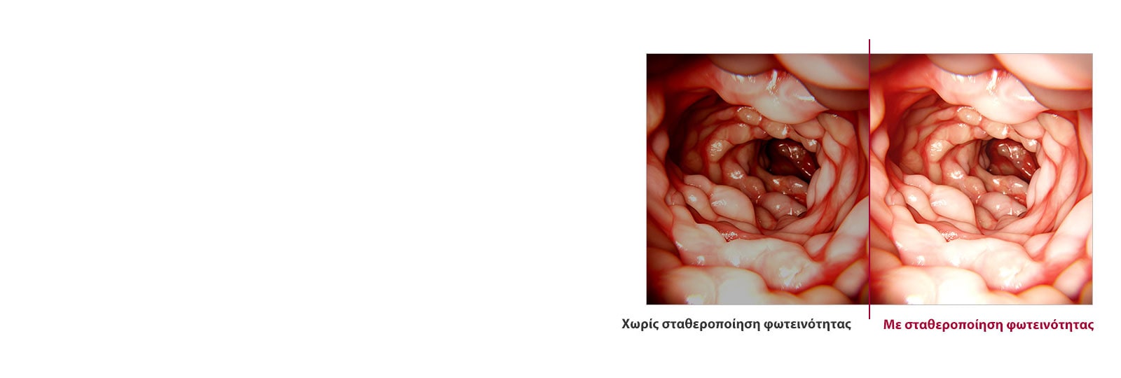 Χωρίς σταθεροποίηση φωτεινότητας σε σύγκριση με Σταθεροποίηση φωτεινότητας