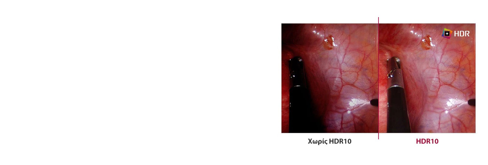 Χωρίς HDR10 σε σύγκριση με HDR10