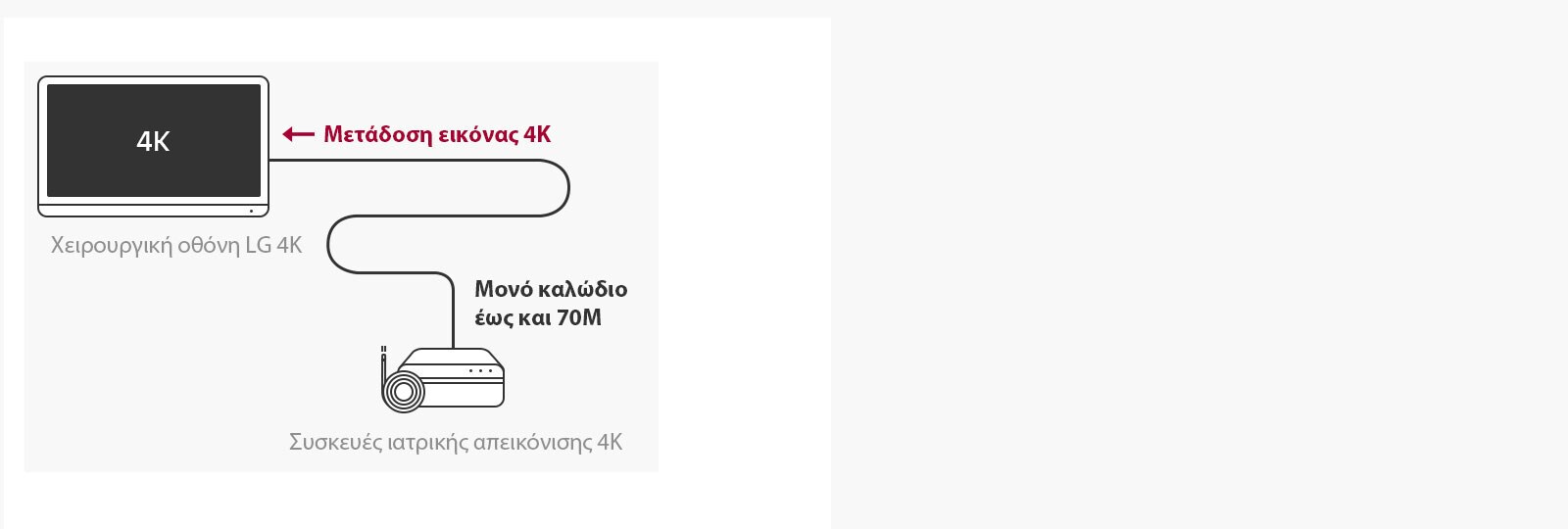 Υποστήριξη 12G-SDI: Η χειρουργική οθόνη ανάλυσης 4K της LG παρέχει τη δυνατότητα μετάδοσης σημάτων 4K σε μεγάλες αποστάσεις μέσω ενός ομοαξονικού καλωδίου χωρίς καθυστερήσεις, για σταθερές συνθήκες χειρουργείου.