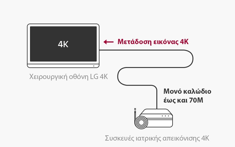 Υποστήριξη 12G-SDI: Η χειρουργική οθόνη ανάλυσης 4K της LG παρέχει τη δυνατότητα μετάδοσης σημάτων 4K σε μεγάλες αποστάσεις μέσω ενός ομοαξονικού καλωδίου χωρίς καθυστερήσεις, για σταθερές συνθήκες χειρουργείου.
