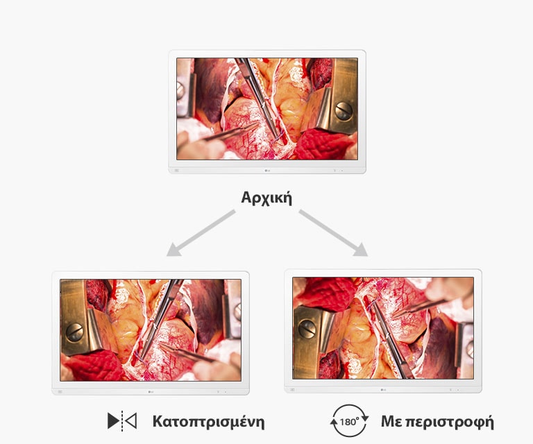 Αρχική οθόνη, κατοπτρισμένη οθόνη και με περιστροφή 180̊
