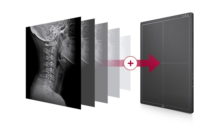 Ενσωματωμένη μνήμη που αποθηκεύει αυτόματα τις εικόνες που λαμβάνονται στον ανιχνευτή, έως και 200 εικόνες