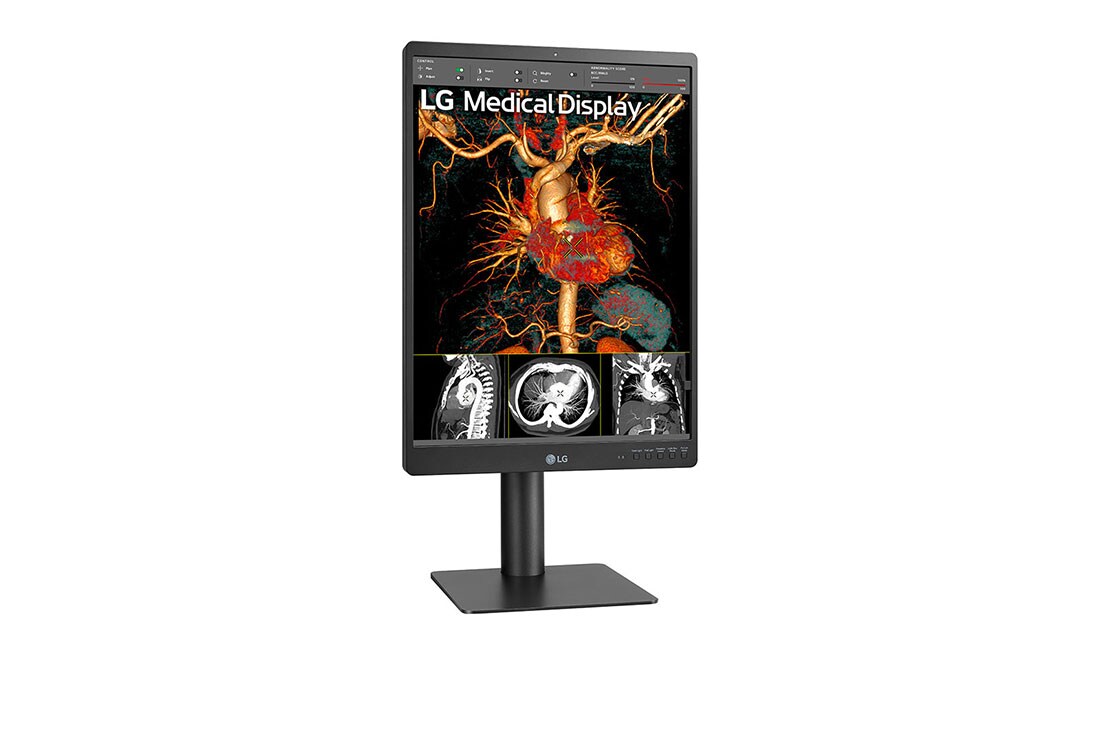 LG Διαγνωστική οθόνη LG IPS 3MP 21,3', πλαϊνή όψη σε γωνία +15 μοιρών, 21HQ513D-B, thumbnail 4