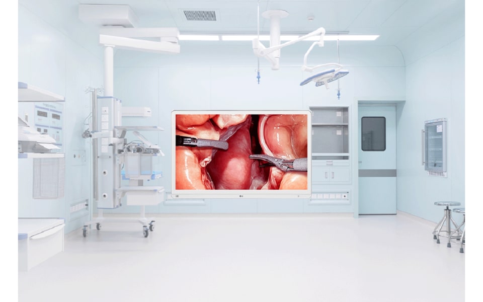 Surgical Monitor (2).png