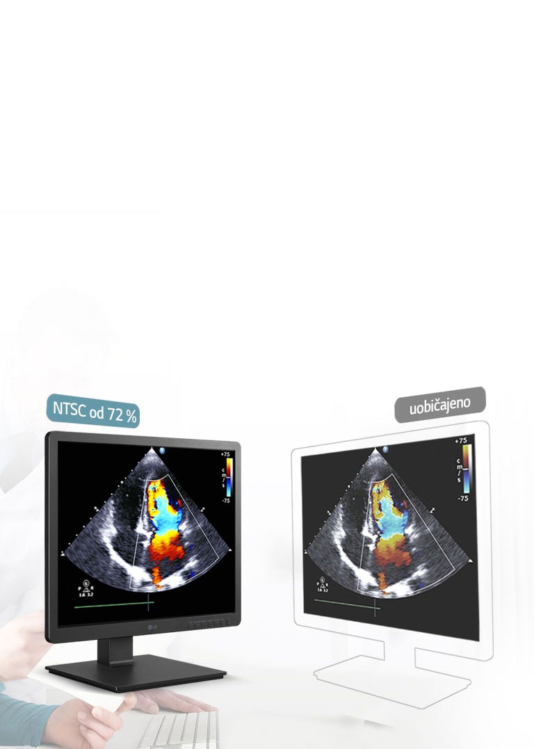 330 nita svjetline i 72% precizna razlučivost NTSC2