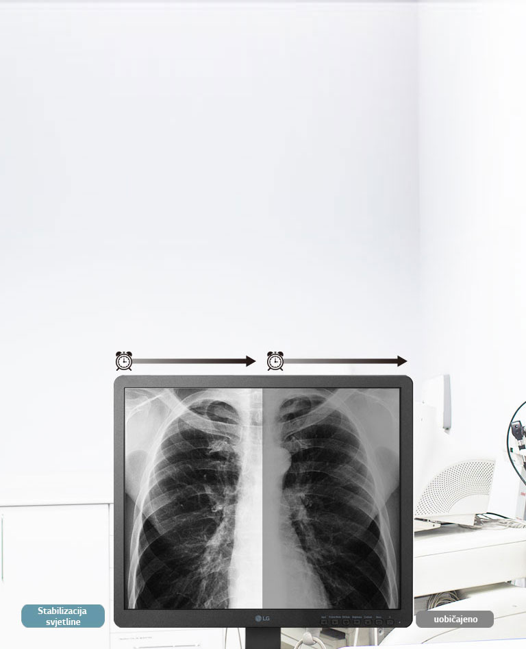 Stabilizacija svjetline2