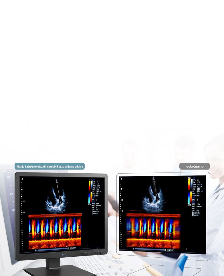 Brzo vrijeme odziva2