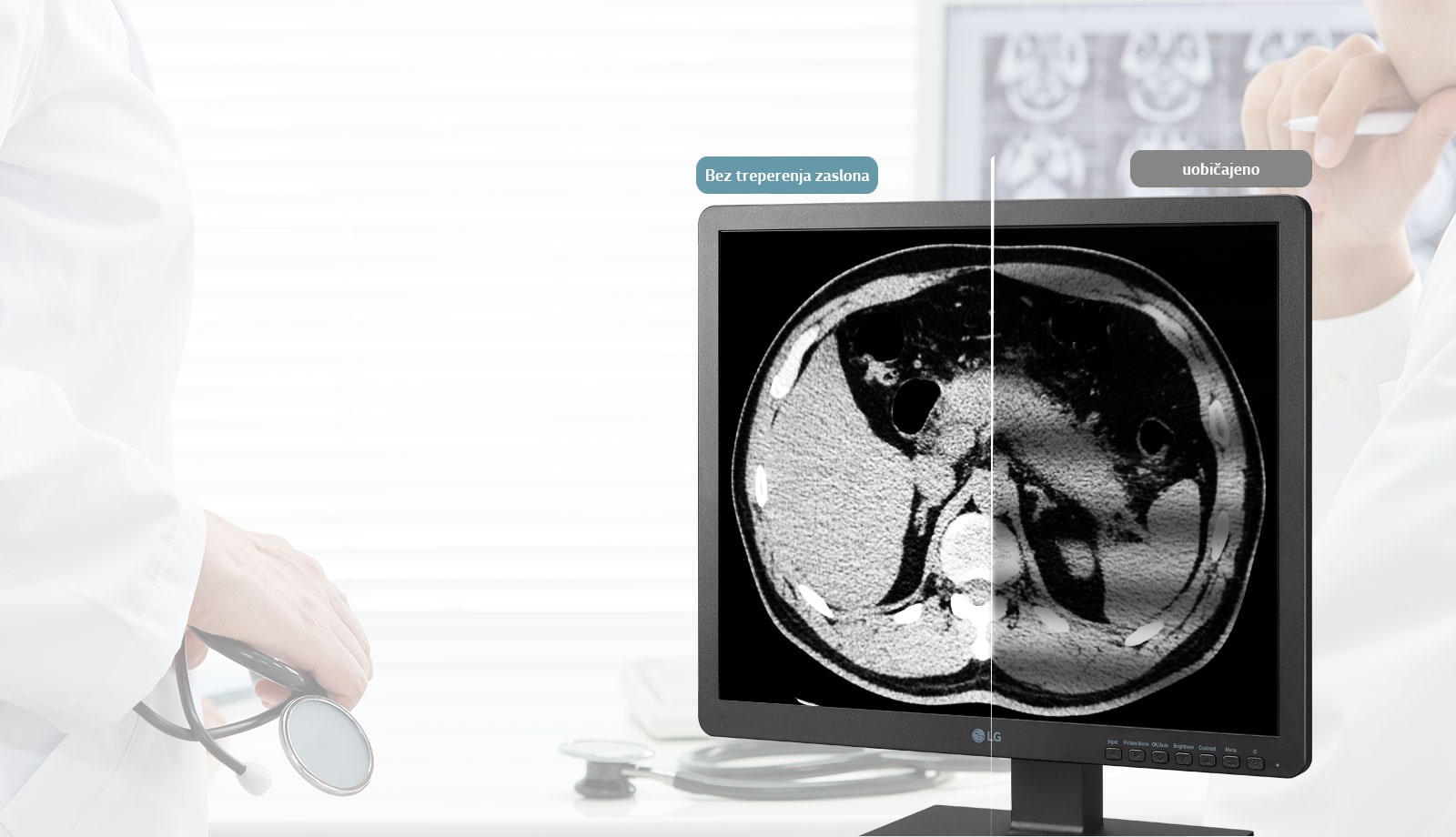 Bez treperenja zaslona1