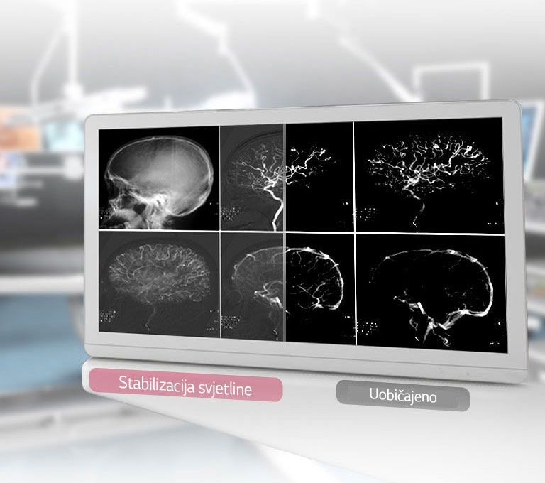 DICOM dio 14 i stabilizacija svjetline 2