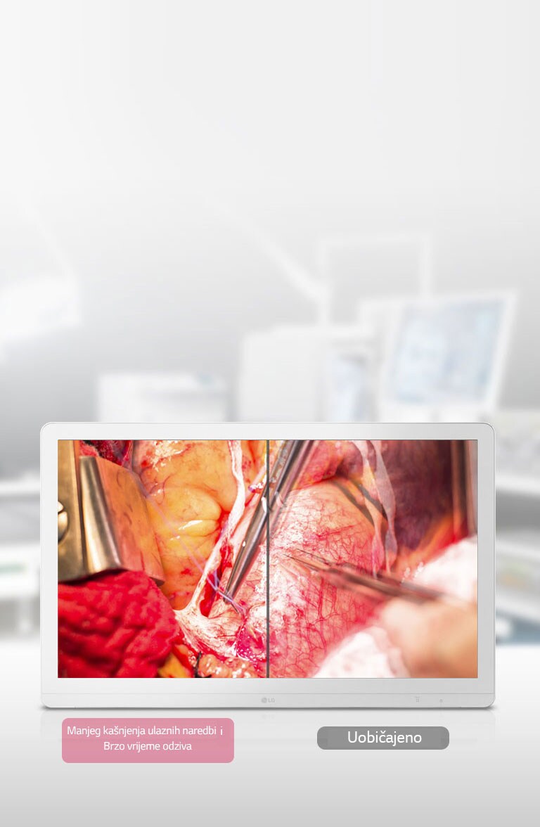 Dinamično sinkroniziranje i brzo vrijeme odziva2