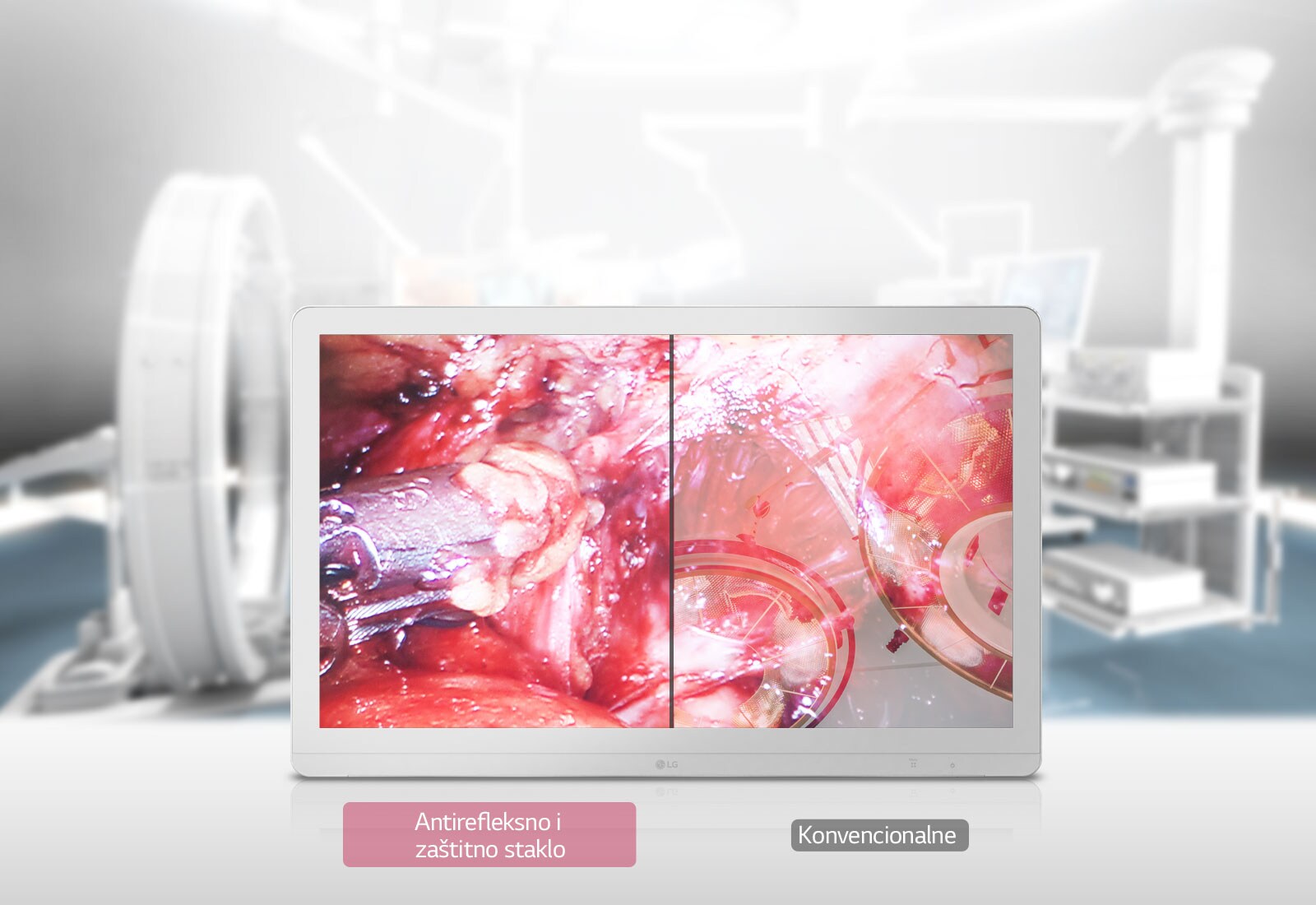 Antirefleksno i zaštitno staklo 1