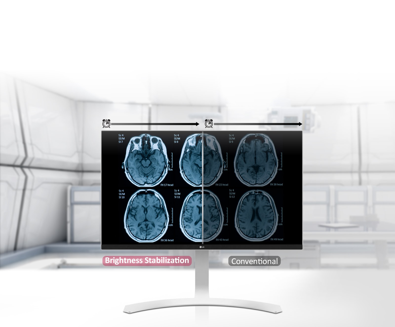 Stabilizacija svjetline <br>1
