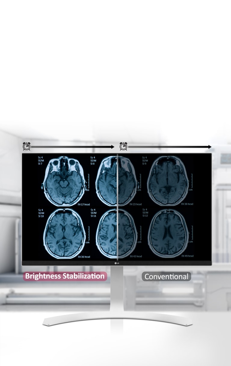 Stabilizacija svjetline <br>2