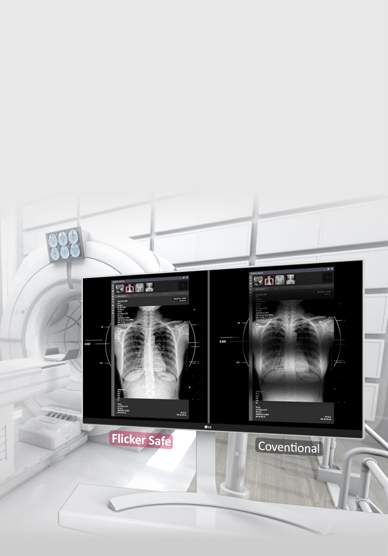 Bez treperenja zaslona<br>2