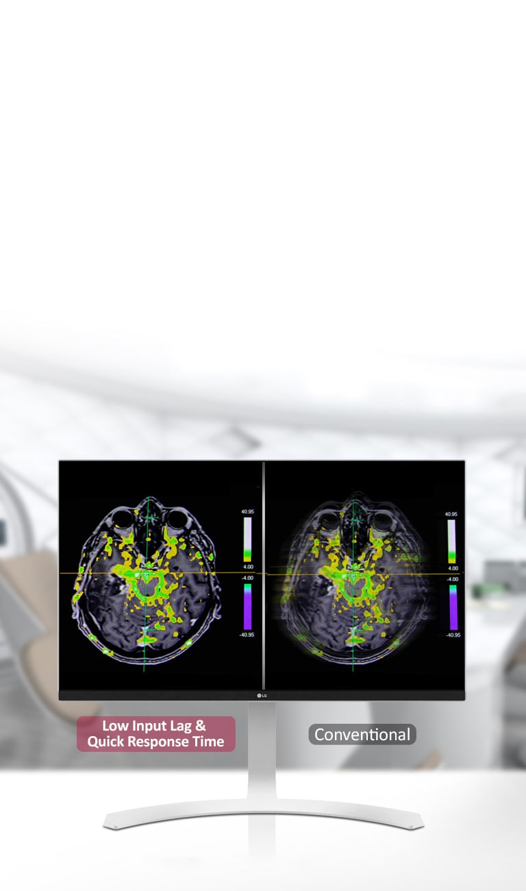 Način rada dinamičnog sink. i brzo vrijeme odziva2