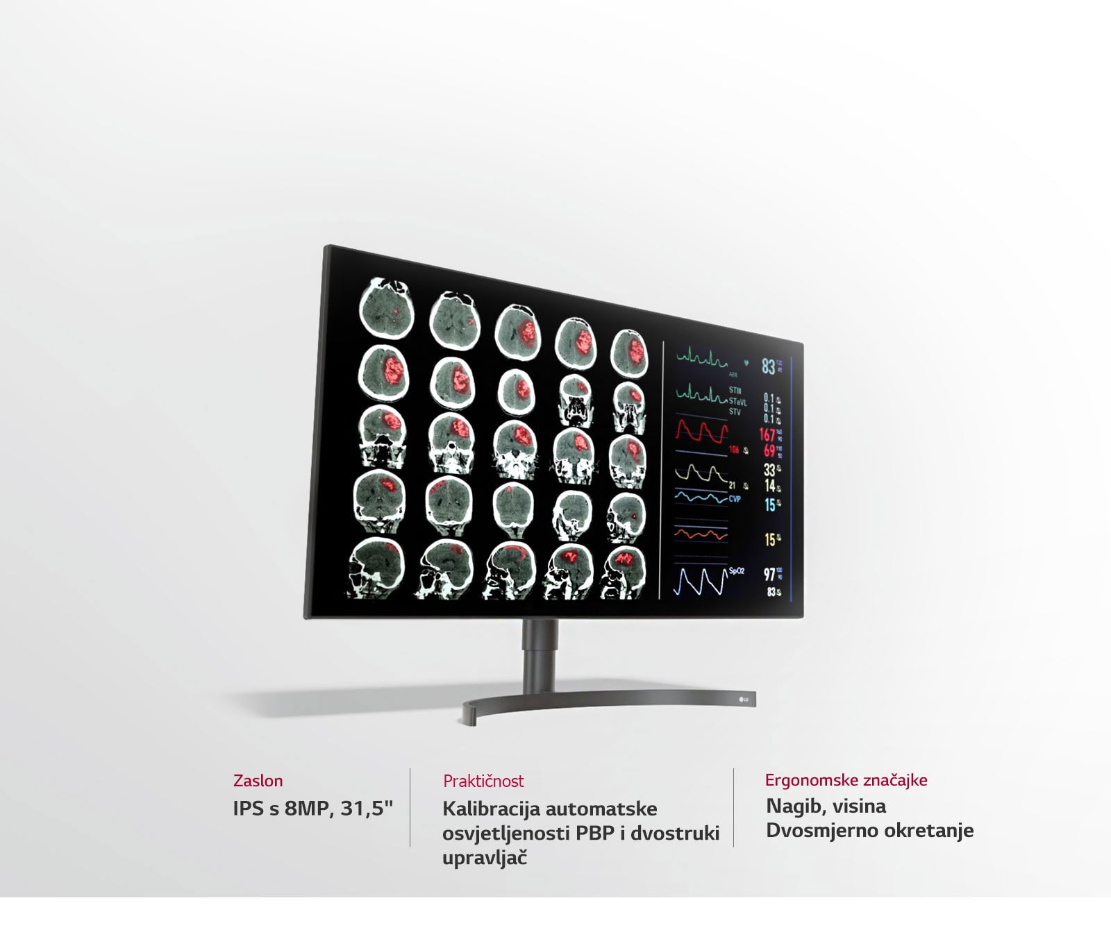 Monitor za dijagnostiku s 8 MP od 31,5"