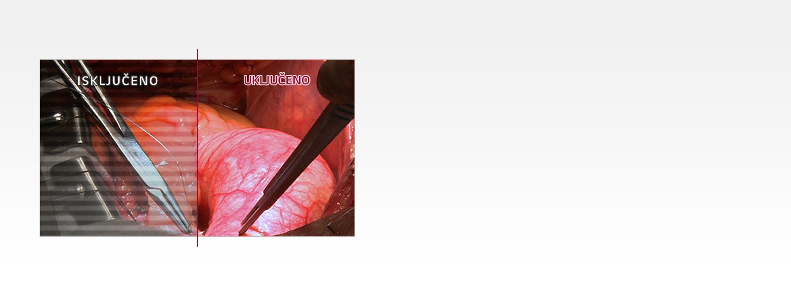 Smanjuje umor očiju1