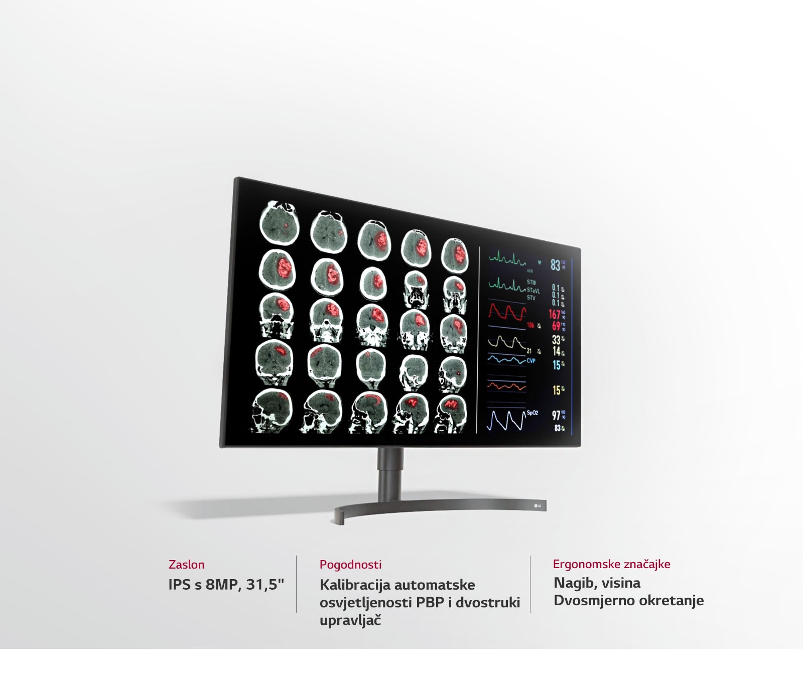 Monitor za dijagnostiku s 8 MP od 31,5"3