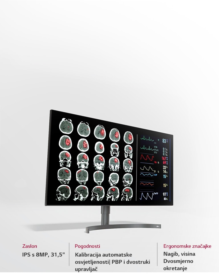 Monitor za dijagnostiku s 8 MP od 31,5"4
