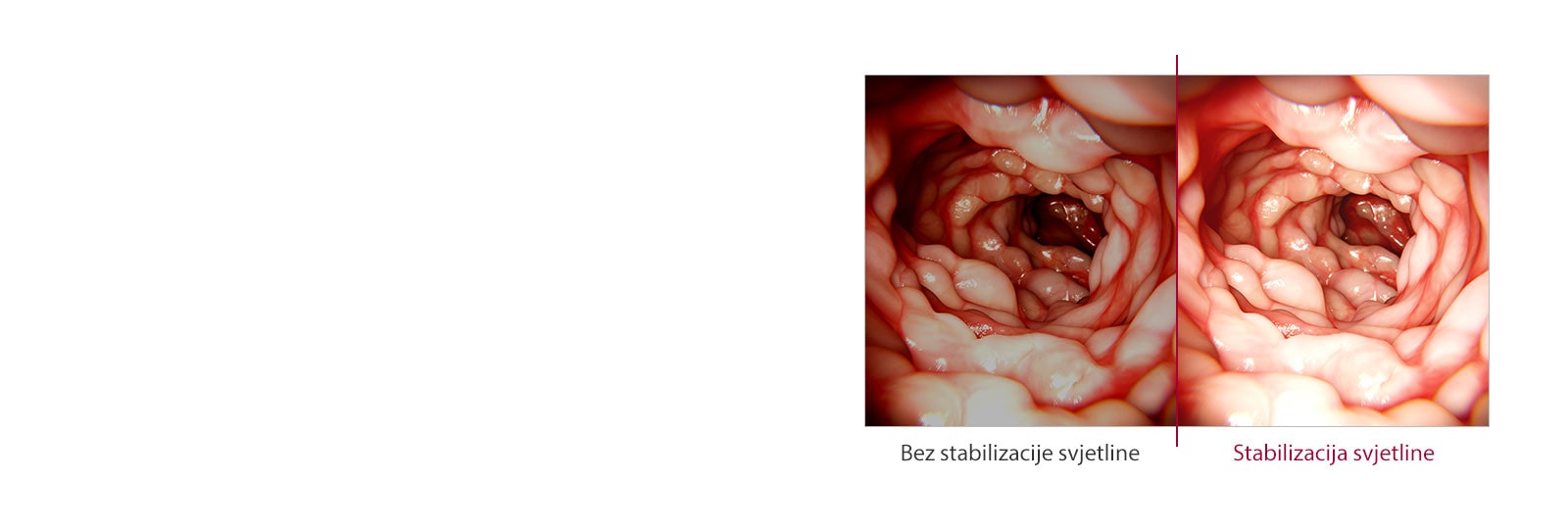 Stabilizacija svjetline1