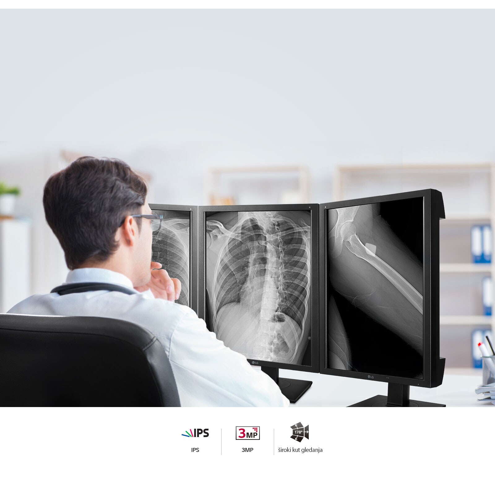 Precizna kvaliteta slike1