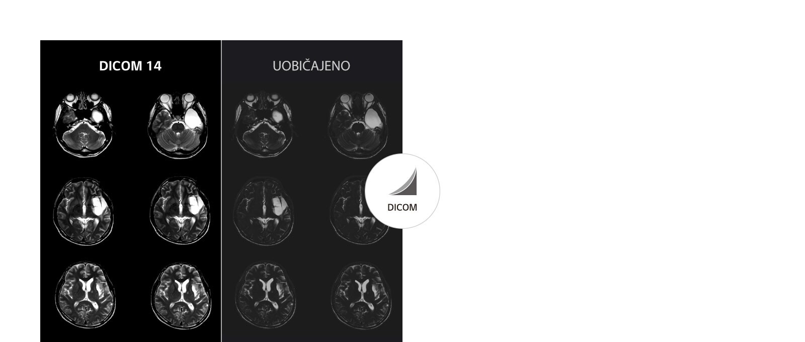 Stabilna slika u nijansama sive1