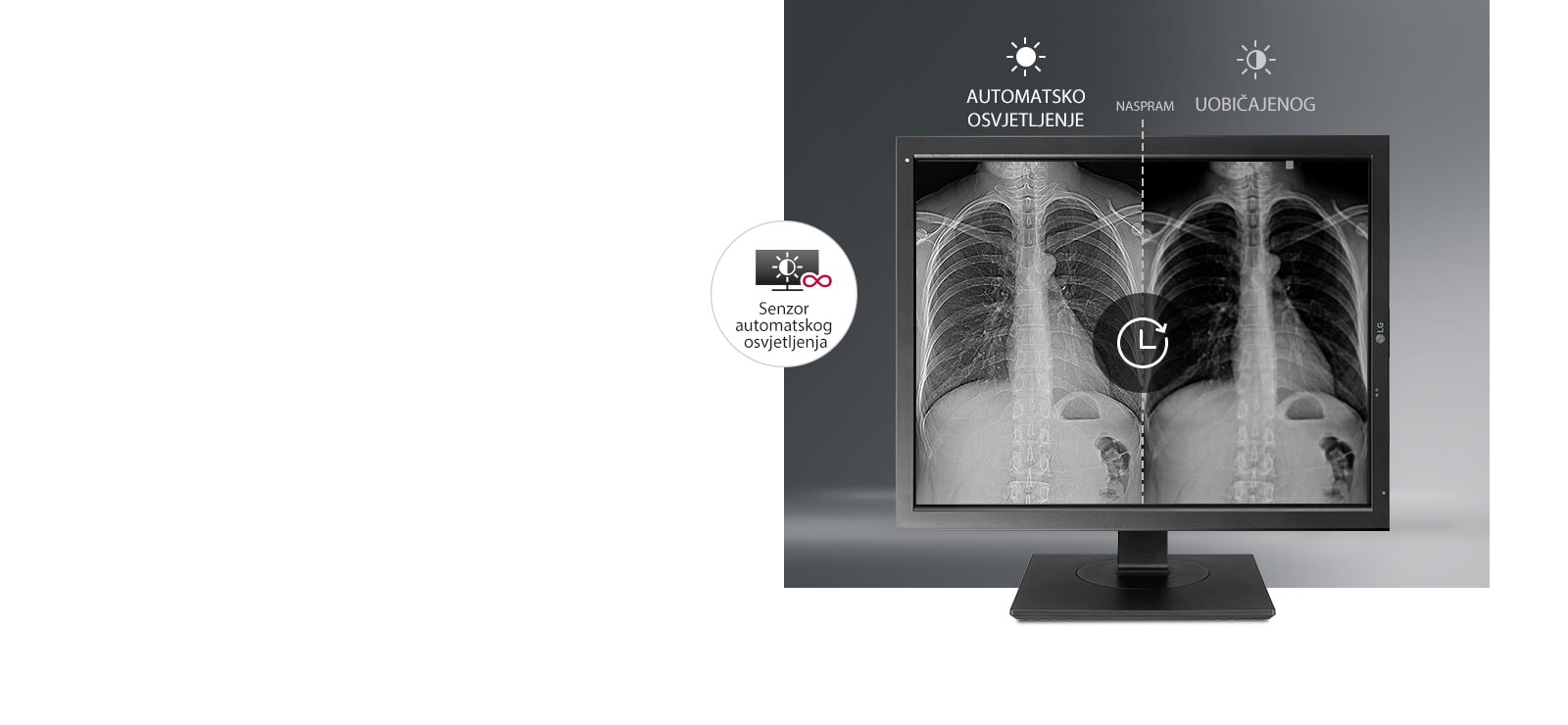 Automatska stabilizacija svjetline1