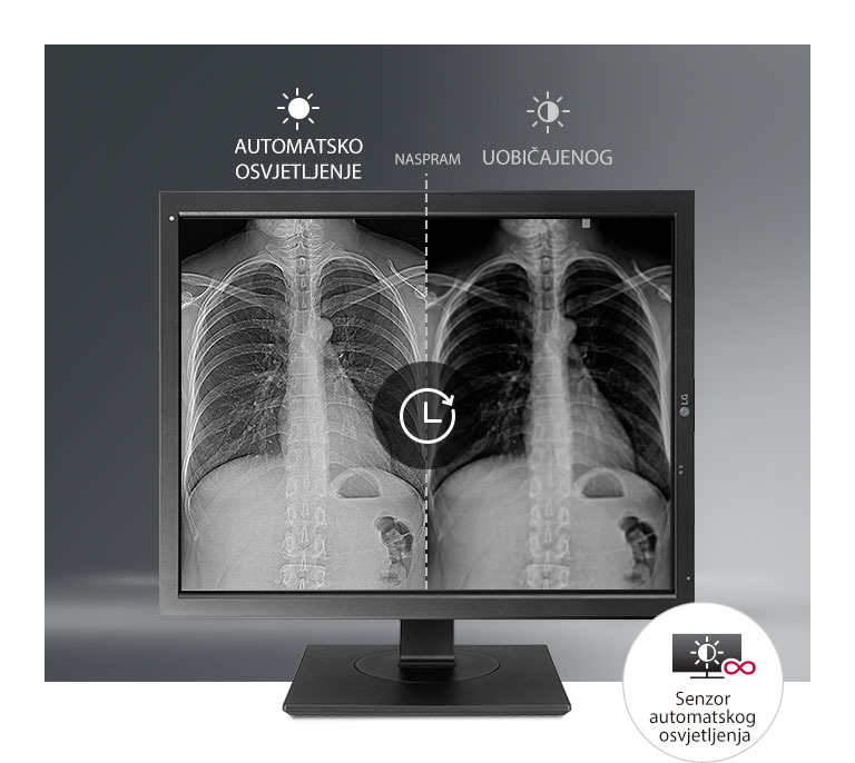 Automatska stabilizacija svjetline2
