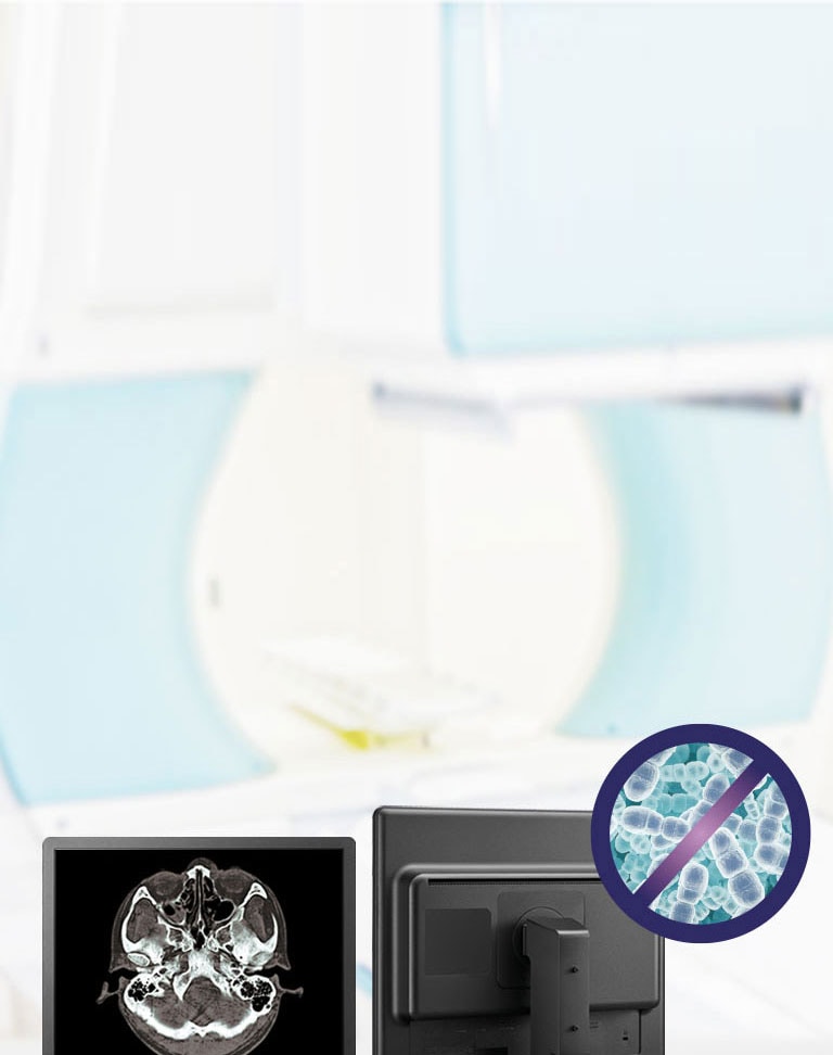 Plastično kućište s antimikrobnim svojstvima2