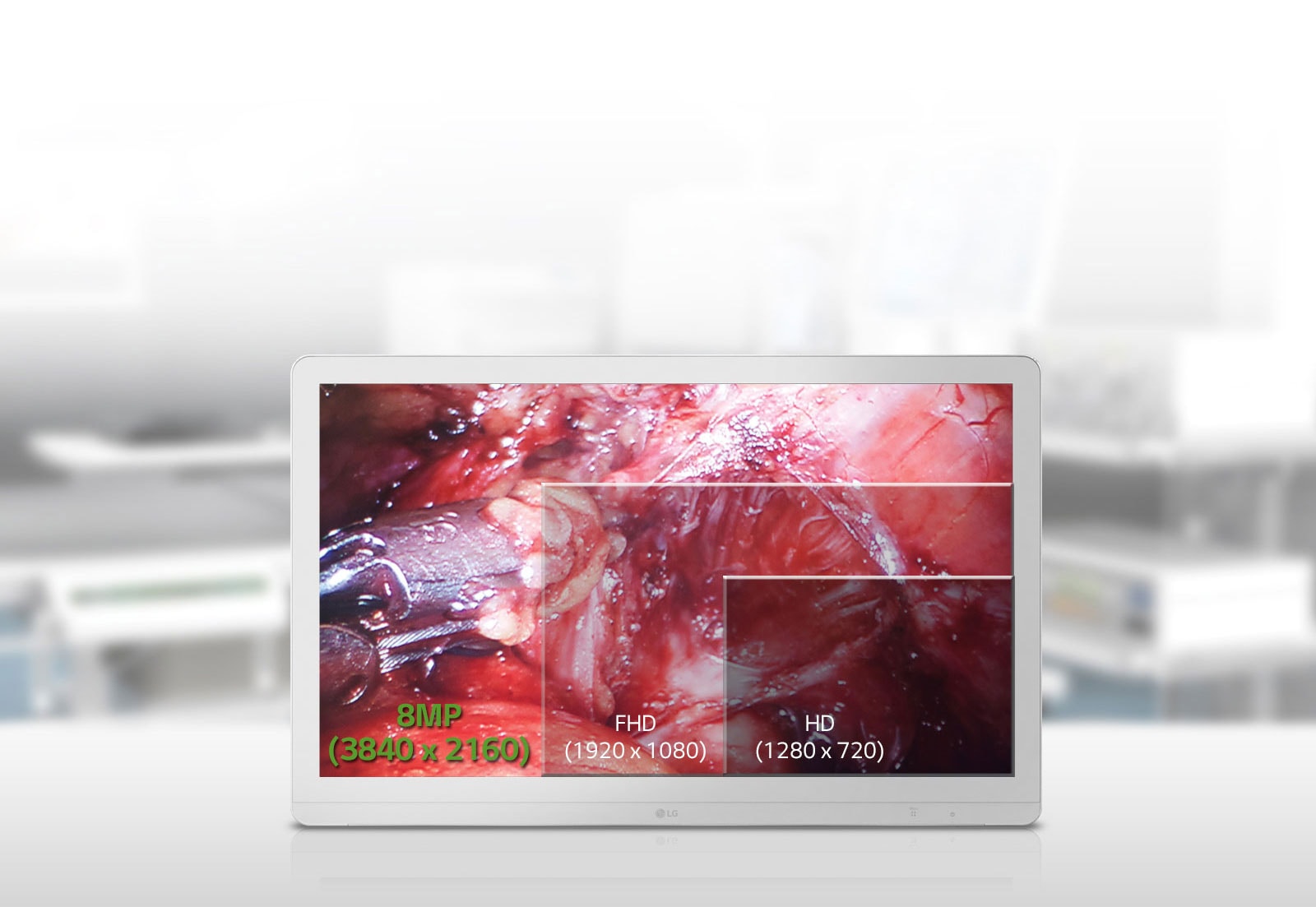 27 IPS 8MP Premium UHD1