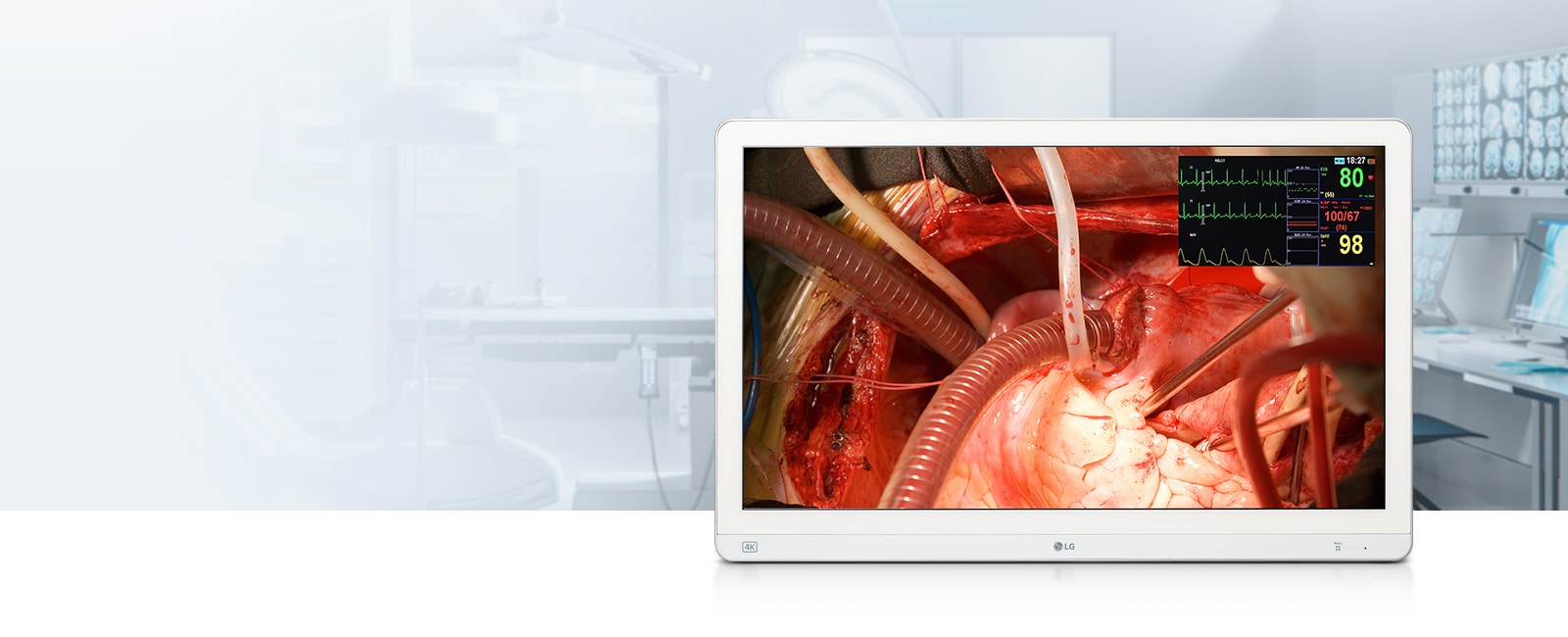 27-inčni 4K medicinski monitor uz Mini-LED