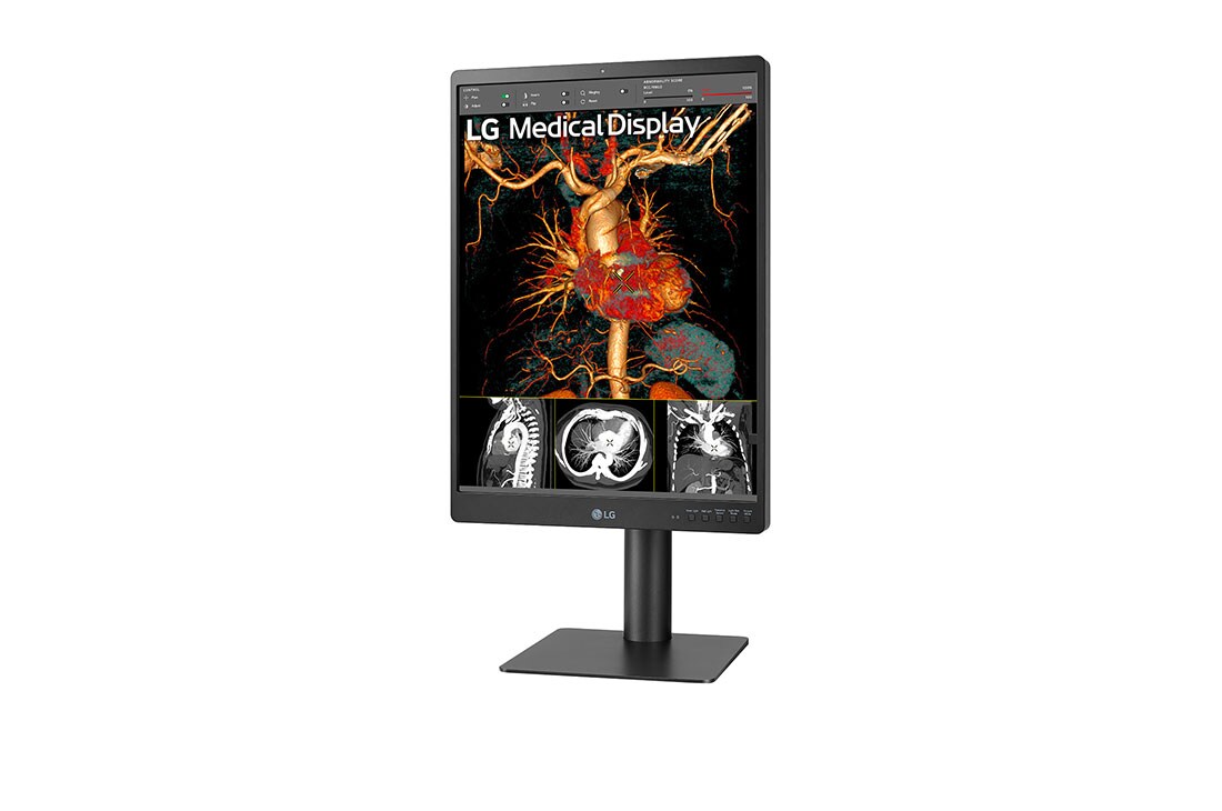 LG Dijagnostički monitor LG 21.3'' 3MP IPS, prikaz bočne strane iz kuta od +15 stupnjeva, 21HQ513D-M, thumbnail 3