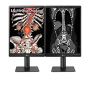 LG Dijagnostički monitor LG 21.3'' 3MP IPS, prikaz prednje strane s 2 zaslona jedan pored drugog, 21HQ513D-M, thumbnail 8