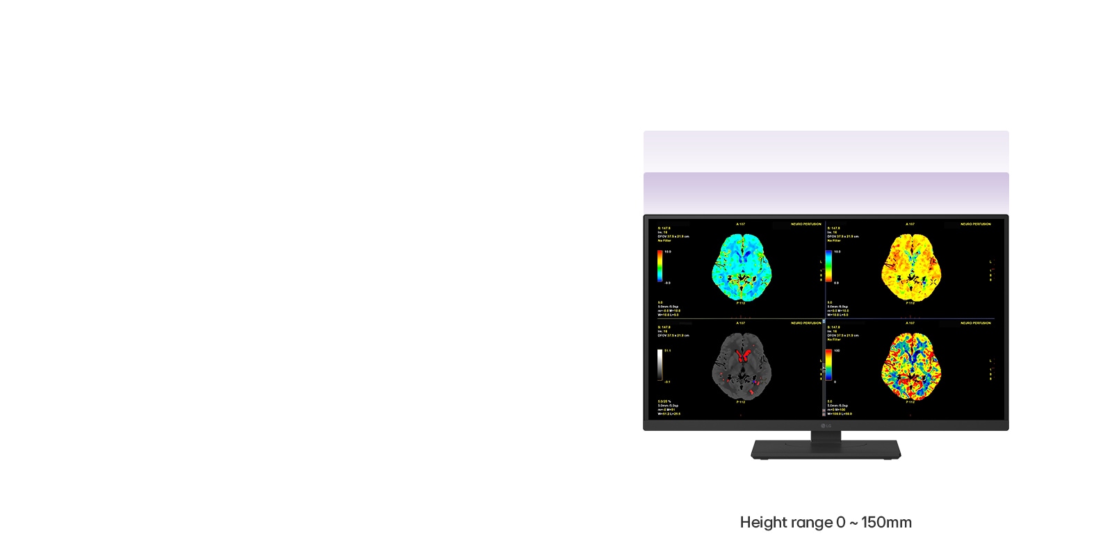 Videozapis prikazuje ergonomske prilagodbe monitora 27HS713C: visina (0–150 mm), okretanje po okomitoj osi (±45°), okretanje vodoravnoj osi (dvosmjerno) i nagib (-5° do 25°).