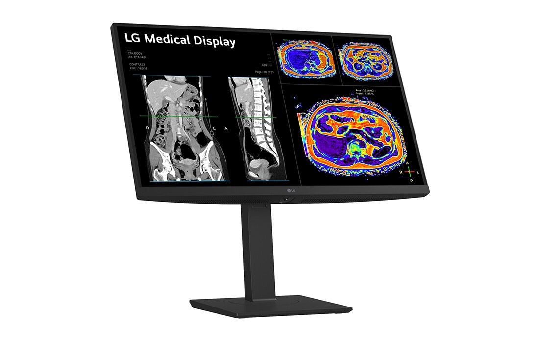 LG 27” 16:9 omjer slike 8MP IPS medicinski monitor, prikaz bočne strane s nagibom od +15, 27HS713C-B, thumbnail 5