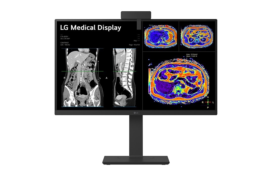 LG 27” 16:9 omjer slike 8MP IPS medicinski monitor, bočni prikaz iz kuta od -15 stupnjeva sa senzorom kalibracije, 27HS713C-B, thumbnail 11