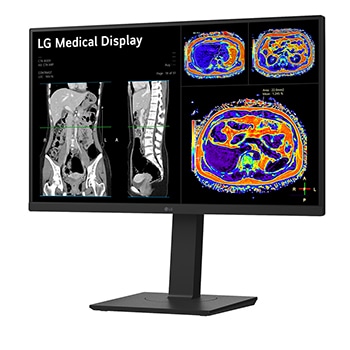 LG 27” 16:9 omjer slike 8MP IPS medicinski monitor, prikaz bočne strane iz kuta od -15 stupnjeva, 27HS713C-B, thumbnail 2