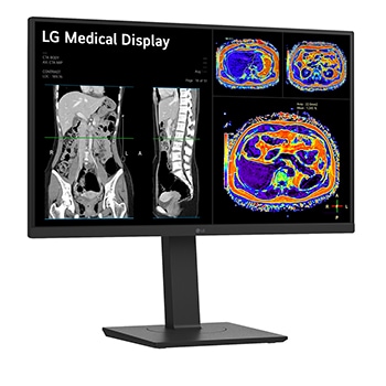 LG 27” 16:9 omjer slike 8MP IPS medicinski monitor, prikaz bočne strane iz kuta od +15 stupnjeva, 27HS713C-B, thumbnail 3