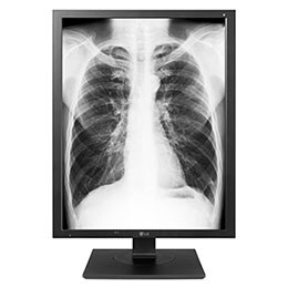 21.3 " LG 3MP dijagnostički monitor2