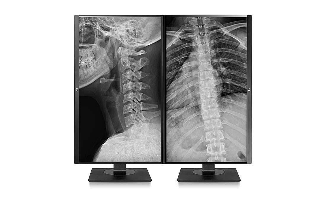 LG 27 '' LG 8MP monitor za kliničke preglede, 27HJ713C-B, thumbnail 10