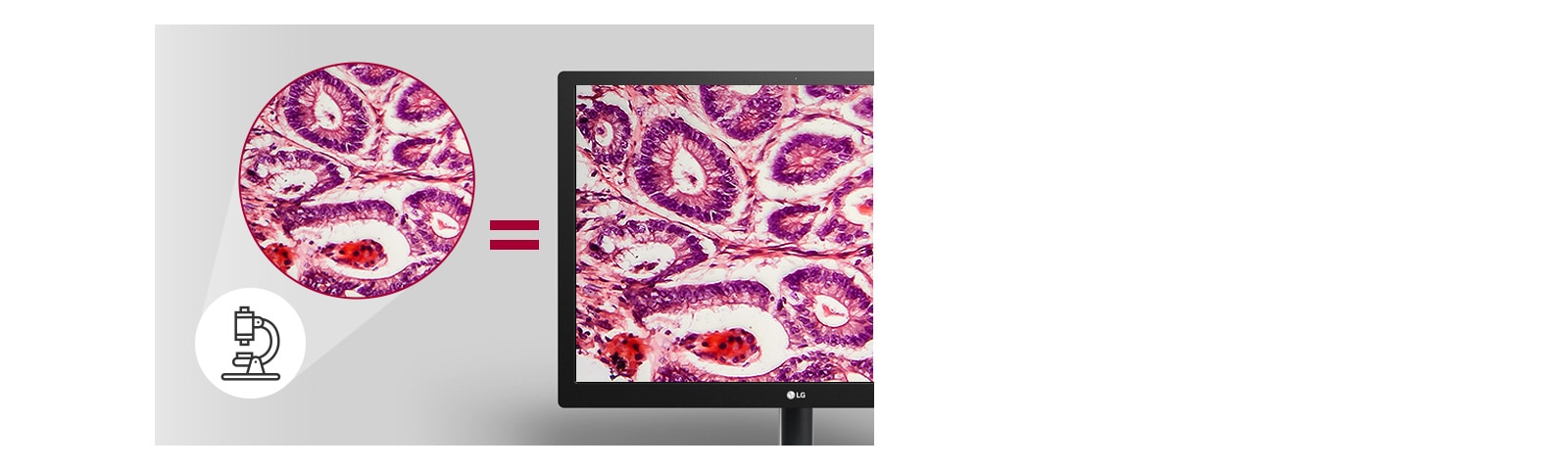 Pathology Mode (Način rada za patologiju) omogućuje rezultate snimanja koji sadržavaju jednake pojedinosti i preciznost boja kao i slika koju gledate na mikroskopu.