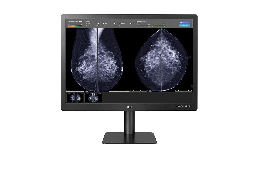 LG 31'' 12MP monitor za dijagnostiku , prednji prikaz monitora s rezultatima mamografskog snimanja prikazanima u programu softvera na zaslonu, 31HN713D-BA, thumbnail 8