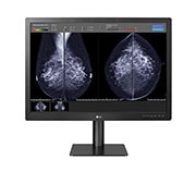 LG 31'' 12MP monitor za dijagnostiku , prednji prikaz monitora s rezultatima mamografskog snimanja prikazanima u programu softvera na zaslonu, 31HN713D-BA, thumbnail 8