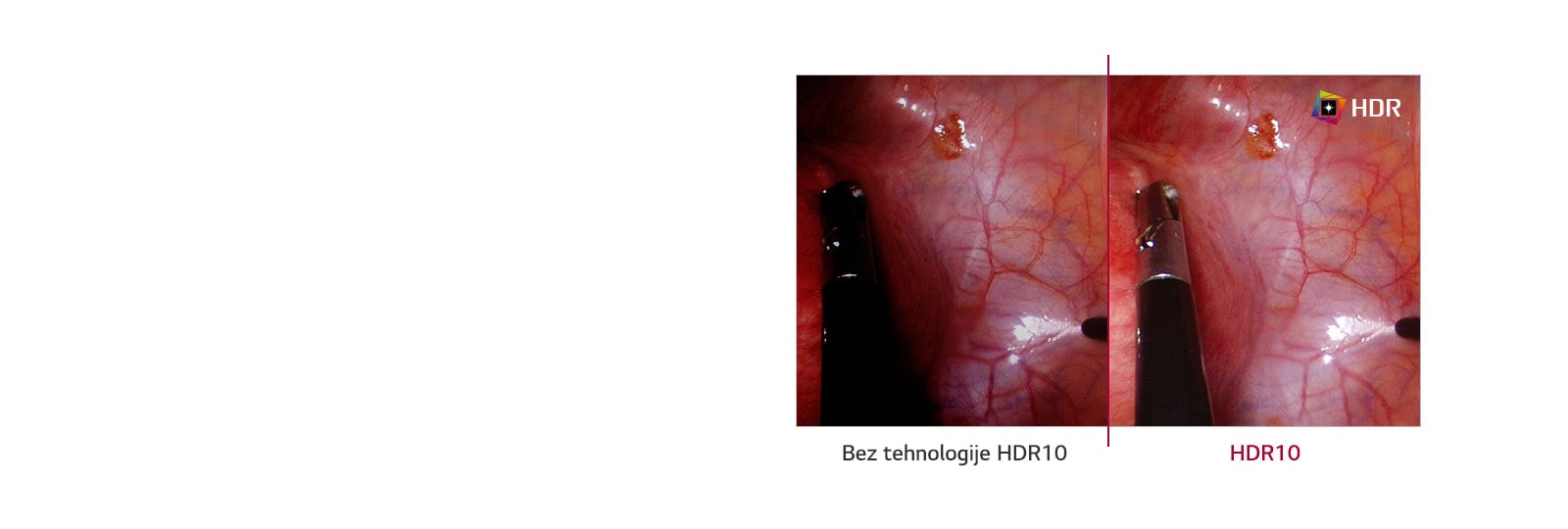 Bez tehnologije HDR10 u odnosu na tehnologiju HDR10