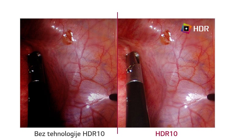 Bez tehnologije HDR10 u odnosu na tehnologiju HDR10