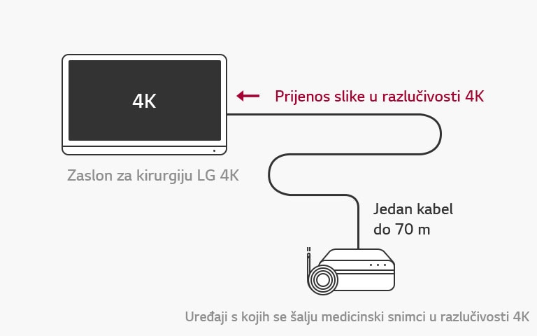Podrška za 12G-SDI: Zaslon za kirurgiju LG 4K omogućuje daljinski prijenos signala razlučivosti 4K putem jednog koaksijalnog kabela bez latencije za postojano izvođenje kirurških postupaka.