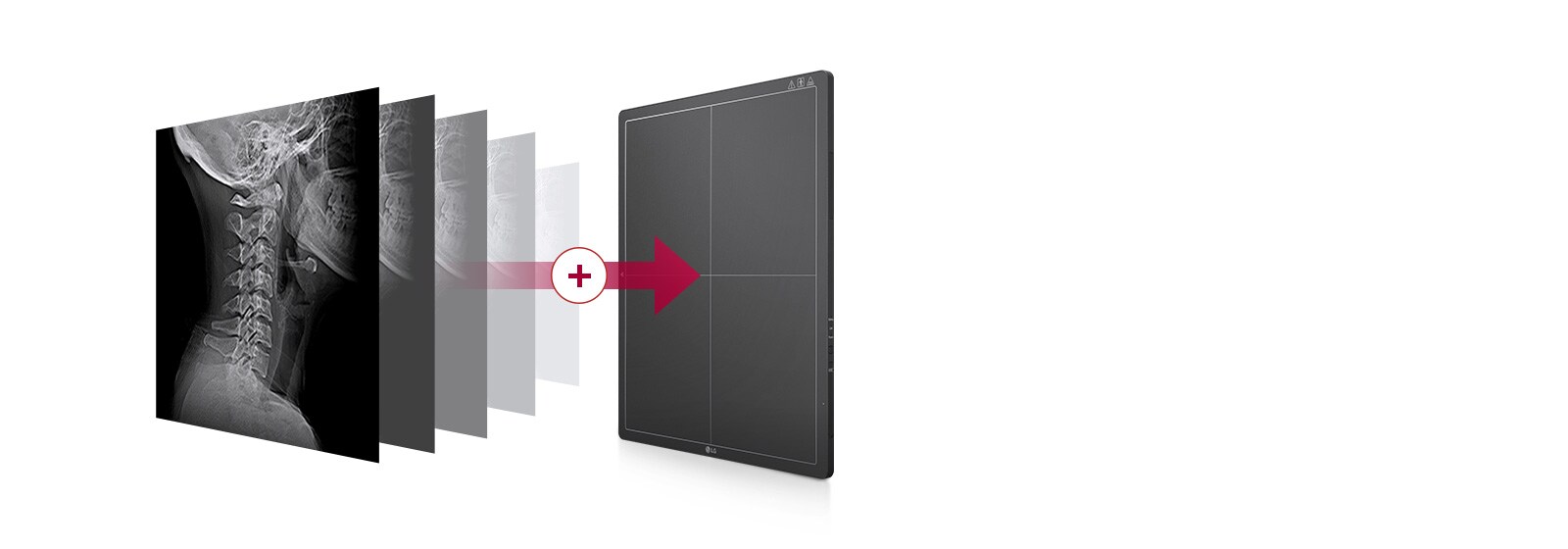 Ugrađena memorija automatski pohranjuje slike snimljene na detektoru; do 200 slika